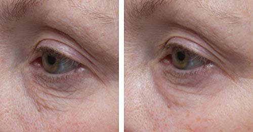 Dr. Denese SkinScience Firming Facial Collagen Eye Cream 1oz – Hydrating Under Eye Treatment with Hyaluronic Acid, Peptides & Ceramides for Puffiness, Dark Circles, Fine Lines – Cruelty-Free Skin Care