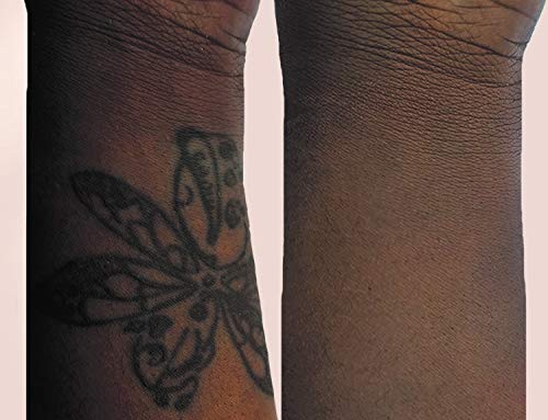 Tattoo Cover Up Makeup, Bruise Concealer, Waterproof, Smudge proof, 3 colors + brush, by Dermaflage, 6.9g/.24oz