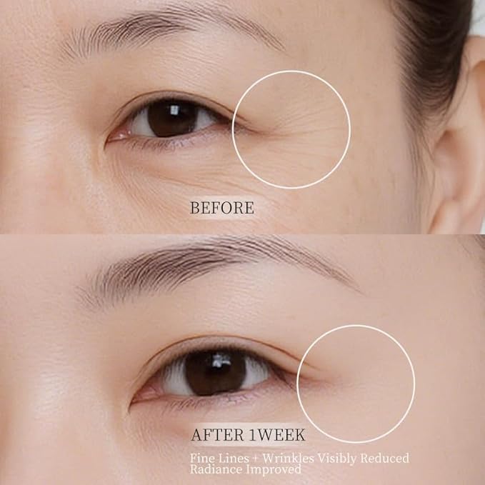 5% PDRN DIY Under Eye Patches Custom Fit on All Face, Under Eye Cream Mask for Puffy eyes, Dark Circles & Wrinkle | Caffeine, Retinol, Collengen, Peptides, Hyaluronic - Korean Popular EyeCare 1.06OZ