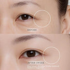 5% PDRN DIY Under Eye Patches Custom Fit on All Face, Under Eye Cream Mask for Puffy eyes, Dark Circles & Wrinkle | Caffeine, Retinol, Collengen, Peptides, Hyaluronic - Korean Popular EyeCare 1.06OZ