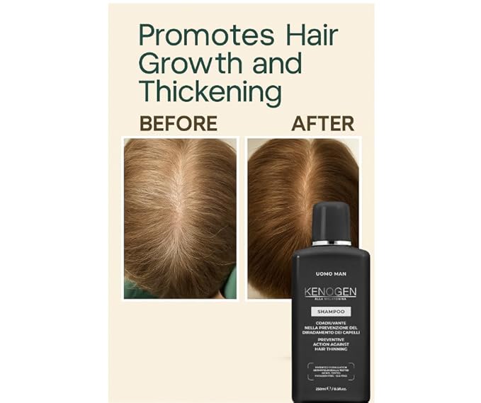 Kenogen Hair Growth Shampoo for Men – Thickening & Volumizing for Thinning Hair – Stimulates Follicles & Regrowth with Melatonin – DHT Blocker – Vegan, Sulfate-Free, Cruelty-Free Formula