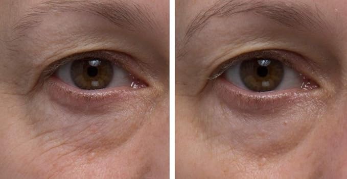 Dr. Denese SkinScience Firming Facial Collagen Eye Cream 1oz – Hydrating Under Eye Treatment with Hyaluronic Acid, Peptides & Ceramides for Puffiness, Dark Circles, Fine Lines – Cruelty-Free Skin Care