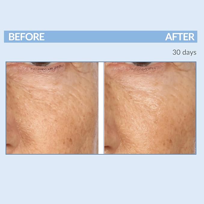 Retinol Anti-Aging Skin Care Set - Serum, Facial Moisture Cream & Face Wash - Smooth Fine Lines, Deep Wrinkles and Minimize Pores - Serious Skincare - 3 Piece Kit