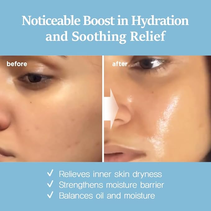 Nightingale Ecto-Hyaluronic Ampoule with 8 layer Hyaluronic Acid, Ectoin, Hyaluronic acid Serum For Dry Skin, Fragrance Free, Hypoallergenic, Allergen Free, Cruelty Free, Vegan, Korean Skin Care