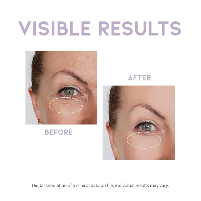 Eye cream for dark circles puffiness and bags anti aging wrinkles korean cream peptide, vitamin c, collagen, vegan under eye treatment 25g