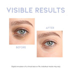 Korean Under Eye Serum for Dark Circles, Wrinkles and Puffy Eye Bags, Hydrating Firming Anti-Aging Treatment with Hyaluronic Acid Vitamin C Caffeine, Vegan Serum 30g