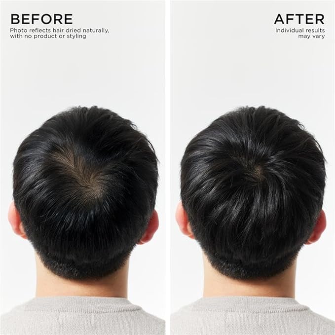 Dr. Groot Hair Thickening Conditioner For Hair loss, Thinning Hair, Korean Hair Care, Biotin Scalp Treatment, Clinically Tested, Thicker Hair, Reduces Oil