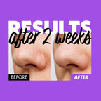 Nosca9 Deep Pore Cleansing Foam for Sensitive Skin | Korean Skincare Face Wash with 17 Amino Acids, White Clay & Patented Pore-Shrinking Ingredient | Deep Cleansing & Moisturizing (5.07 fl. oz)