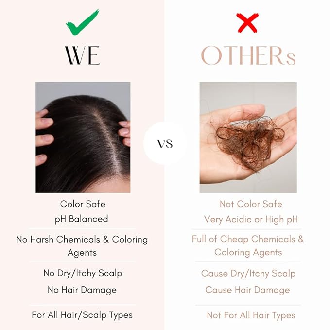 K C Scalp Detox & Hair Treatment Mask - Deep Conditioner for Dry Scalp & Damaged Hair – Scalp Care for Buildup, Flakes & Oil Control – All Hair/Scalp Types – Spa Grade Formula (FLORAL)