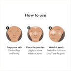 Hero Cosmetics Mighty Patch™ Face Patch - XL Hydrocolloid Face Mask for Acne, 5 Large Pimple Patches for Zit Breakouts on Nose, Chin, Forehead & Cheeks (1 Count)