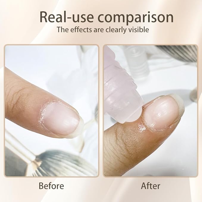 2pcs Cuticle Oil Roller Nourishing Cuticle Oil for Nails Hydrating and Cuticles Moisturizing Nail Care Products(Lemon & Rose)