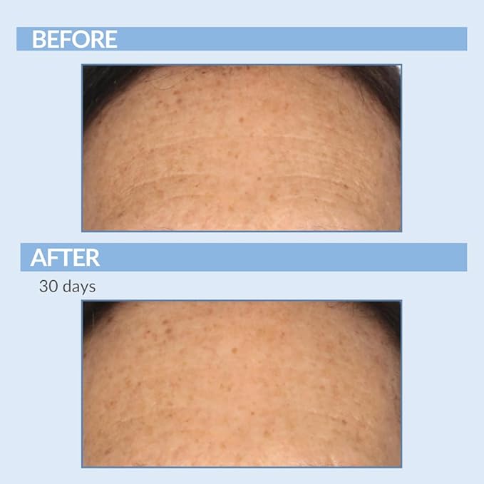 Retinol Anti-Aging Skin Care Set - Serum, Facial Moisture Cream & Face Wash - Smooth Fine Lines, Deep Wrinkles and Minimize Pores - Serious Skincare - 3 Piece Kit