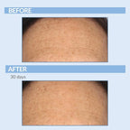 Retinol Anti-Aging Skin Care Set - Serum, Facial Moisture Cream & Face Wash - Smooth Fine Lines, Deep Wrinkles and Minimize Pores - Serious Skincare - 3 Piece Kit