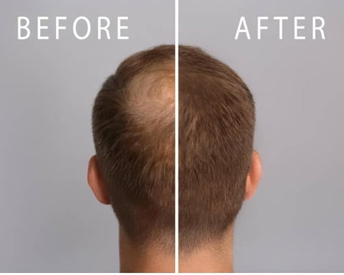 Hair Growth for Men and Women-27 All Natural Proven Ingredients Awaken Hibernating Cells/Roots-Stimulates and Nourishes the Scalp, Slows Loss and Gives You Fuller, Thicker Hair