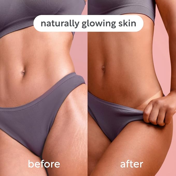 Self Tan Mousse, Customizable Medium Self Tanning Foam, Natural Looking Tan, Quick-Drying, Dermatologist Approved for Sensitive Skin, Hydrating Coconut Water, Tropical Scent, 6.76 fl oz