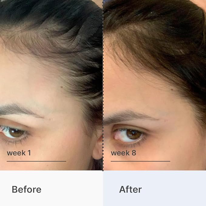 Better Not Younger Hair Thickening Serum for Women Over 40 – Scalp Care, Hair Density Treatment and Anti-Aging 2fl.oz – Fortifying Serum with Biotin & Ginger. Promotes Stronger, Thicker-Looking Hair.