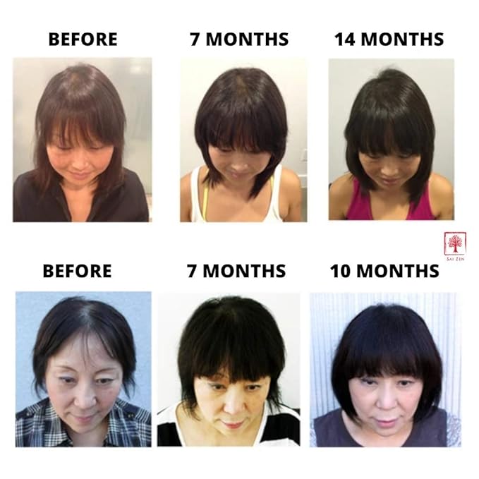 Volume Plus Scalp Therapy Spray | Post-Shower Hair Strengthening Formula | Made in USA |Alcohol and Paraben Free, 4 oz.