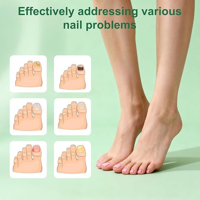 2PCS Nail Repair Gel - Multi-Purpose Nail Growth Support Cream, Nail Care Repair Formula