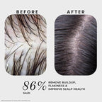 K C Scalp Detox & Hair Treatment Mask - Deep Conditioner for Dry Scalp & Damaged Hair – Scalp Care for Buildup, Flakes & Oil Control – All Hair/Scalp Types – Spa Grade Formula (FRESH)