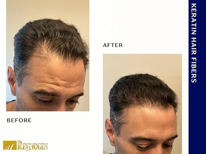 Revivogen MD Keratin Hair Building Fibers, Hairline Powder, Hair Fibers, Hair Fibers for Thinning Hair, Hair Fiber Spray, Thick Fiber for Hair Men and Women, Hair Filler, .9oz, Medium Brown