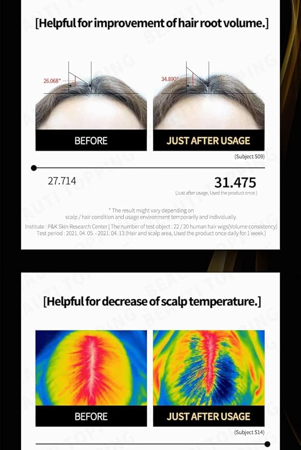 Hair Growth Tonic Serum - Hair Thickening Scalp Treatment, Anti Hair Loss & Root Strengthening, Instant Cooling & Soothing Care for Thinning Hair, 5.41 fl. oz