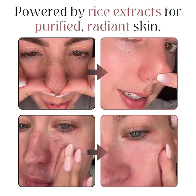 Peel Shot Glow Rice Ampoule Duo, Daily White Rice Ampoule + Weekly Black Rice + Activated Charcoal, Vegan, Cruelty-Free Skin Treatment 2x80ml