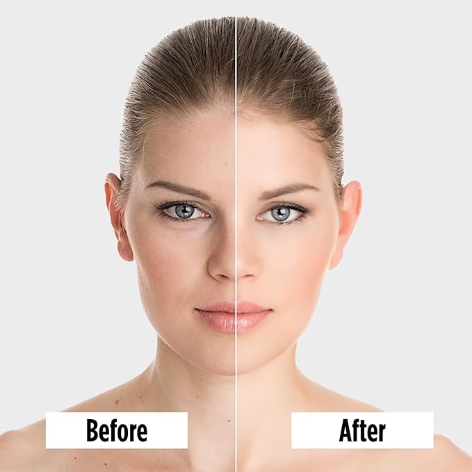 Intense Repair Eye Cream Lightweight Retinol, Peptides & Vitamin C Formula for Dark Circles, Puffiness & Fine Lines – Anti-Aging, Paraben-Free & Cruelty-Free