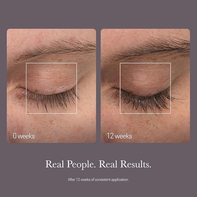 NULASTIN Follicle Fortifying Lash Serum - Clinically Tested Eyelash Enhancing Serum - Nourishes & Repairs to Promote Longer-Looking Lashes - Enriched with Hair-Strengthening Ingredients (2 Count)