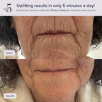 Pulsating Facial Lift | 5 Minute Age Reversal Device, Contours & Improves Facial Structures, Tightening & Toning of Skin