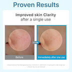 CENTELLIAN 24 Madeca Lab Hyal Waterfull Gel Mask (Hydrating Gel Mask, 4 pcs) – Deep Moisture & Cooling Sheet with 10-Layer Hyaluronic Acid, Korean Skin Care. TECA, Glycerin, Niacinamide.