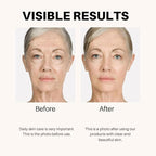 Anti-Aging Lifting & Firming Cream – Hydrating & Tightening Formula for All Skin Types – Paraben-Free, Fragrance-Free, BHA-Free (1.7 fl oz / 50 ml)