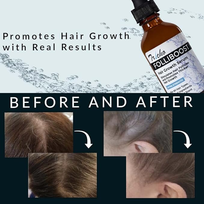 Tricho Labs Folliboost Hair Growth Serum - Natural-Based Formula w/Biotin & Peppermint Oil - Hair Care for Thicker & Fuller Hair - 2oz, 3-Pack