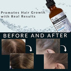 Tricho Labs Folliboost Hair Growth Serum - Natural-Based Formula w/Biotin & Peppermint Oil - Hair Care for Thicker & Fuller Hair - 2oz, 3-Pack