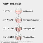 0.9% KX-826 KINTOR Hair Growth Spray,Strengthen Hair Nourish Hair follicles,Hair Care Products for Sparse Hair and Oily Hair Men&Women,300ml,Pro