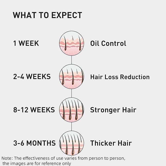 0.5% KINTOR KX-826 Hair Growth Spray,Oil Control Strengthen Hair,Hair Regrowth Products for Women&Men,Basic,180ml