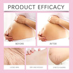 Stretch Mark Pregnancy Oil, Natural Oil Skincare Body Oil Serum for Scars and Stretch Marks, Face with Vitamin E & A for Sensitive Dry Skin and Body Moisturizer