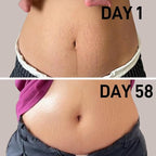 Stretch Mark Oil for Pregnancy & Body Oil for Pregnant Women, Morocco Nut Oil Help for Scars & Stretch Marks Removal & Prevention, Belly Cream for Repair, Firming & Smoothing Fine Lines (1Pack/50ml)