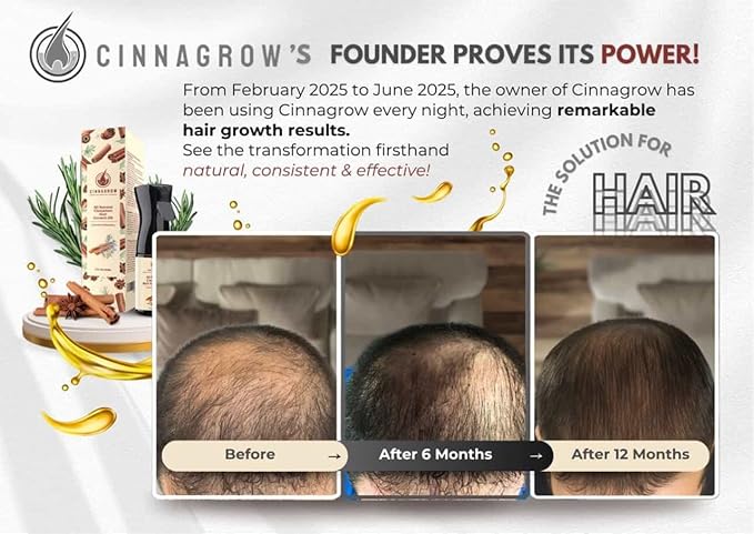 Hair Growth Oil with Rosemary & Cinnamon – Thicker Hair, Scalp Nourishment & Strength – Lightweight, Non-Greasy, Fast Absorbing Formula – 60 ml (2 fl oz) Bottle with Pump Dispenser