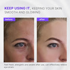 2-in-1 Eye Cream Applicator and Ice Roller, Face Massager Tool for Puffiness, Eye Bags, Muscle Ache