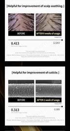 Hair Growth Tonic Serum - Hair Thickening Scalp Treatment, Anti Hair Loss & Root Strengthening, Instant Cooling & Soothing Care for Thinning Hair, 5.41 fl. oz