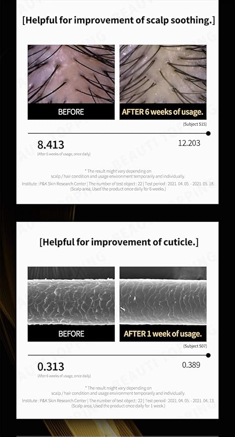 Hair Growth Tonic Serum - Hair Thickening Scalp Treatment, Anti Hair Loss & Root Strengthening, Instant Cooling & Soothing Care for Thinning Hair, 5.41 fl. oz