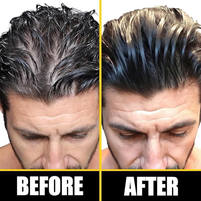 Pete & Pedro BOOST Hair & Beard Strengthening & Growth Natural Scalp Health Serum Oil For Men & Women - With Rosemary, Biotin & 20 plus Essential Oils | Shark Tank Featured, 2 oz.