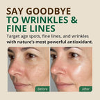 Vitamin E Oil - 100% Pure & Natural, 85,800 IU. Repair Dry, Damaged Skin from Surgery & Acne, Age Spots & Wrinkles. Boost Collagen for Moisturized, Youthful-looking Skin. d-alpha tocopherol, 2 Fl Oz