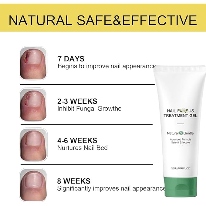 2PCS Nail Repair Gel,Nail Treatment Cream,Multi-Purpose Nail Repair, Nail Growth Serum for Damaged Nail