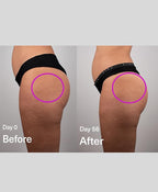 SickScience DropOff Advanced Exosome Body Firming & Sculpting Cream | Targets Stretch Marks, Cellulite, the Belly Area & Loose Skin, Including After Pregnancy, 100ml