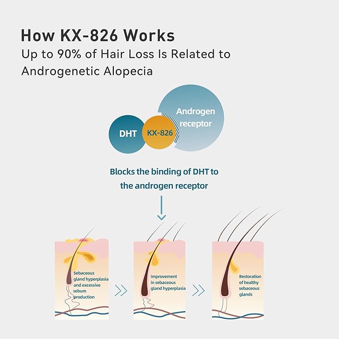 0.9% KX-826 KINTOR Hair Growth Spray,Strengthen Hair Nourish Hair follicles,Hair Care Products for Sparse Hair and Oily Hair Men&Women,240ml,Pro