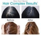 Silver Fern Hair Complex Hair Supplement - Each Bottle Contains a 30-Day Powder Supply - 1 Bottle