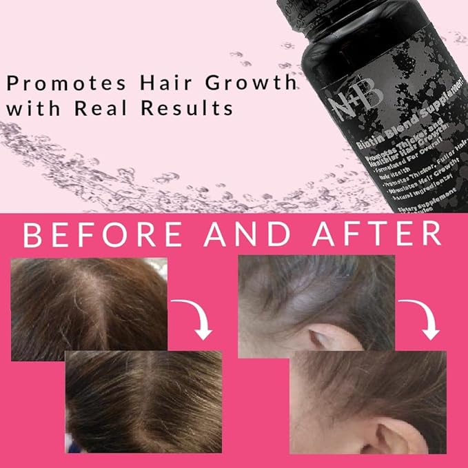 Nicole + Brizee N+B Hair Growth Vitamins - with Biotin, Vitamin C, Zinc, and Vitamin B12 - Natural-Based Hair Care Formula - Made in The USA - (30 Day Supply)(6-Pack)