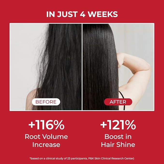 MOEV ANNURCATIN Shampoo and Conditioner Set for Men and Women, Korean Biotin Hair Growth Volumizing Shampoo, Paraben-Free Natural Apple Wash-Off Hair Mask, Rose Thickening for Damaged Hair