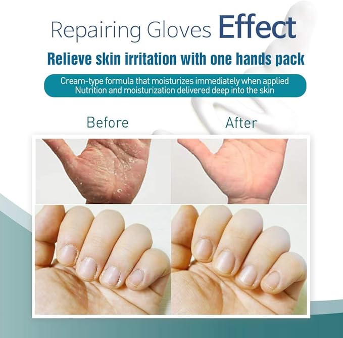 Epielle Intensive Repairing Hand Mask 6 Pairs, Renew and Soften with Coconut Oil & Milk Extract, Deep Moisturizing Gloves for Dry, Cracked Hands, Self Care Gifts for Women, Spa Kit, Stocking Stuffers